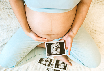 Perda auditiva é hereditária?