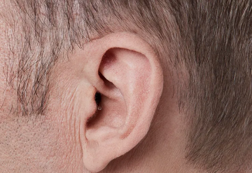 Aparelhos estão se tornando menores e mais discretos: o futuro é invisível