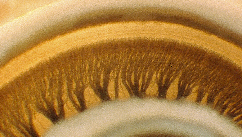 As células ciliadas danificadas podem ser recuperadas?